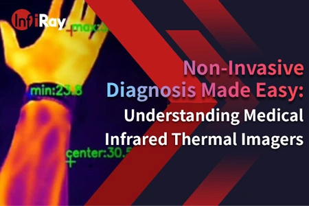Diagnostic non invasif rendu facile: comprendre les imageurs thermiques infrarouges médicaux